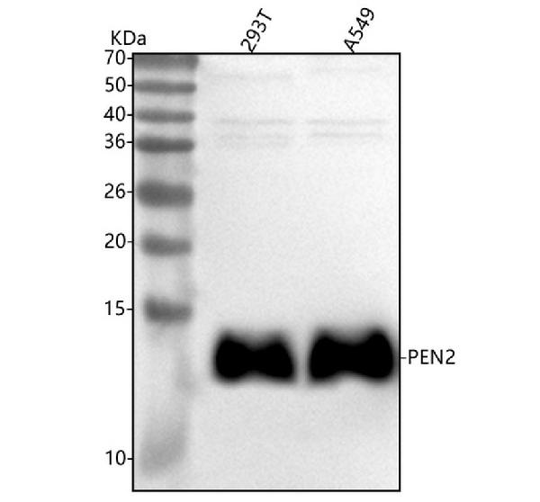 1 - Anti-PEN2 Rabbit Monoclonal Antibody ABO15489