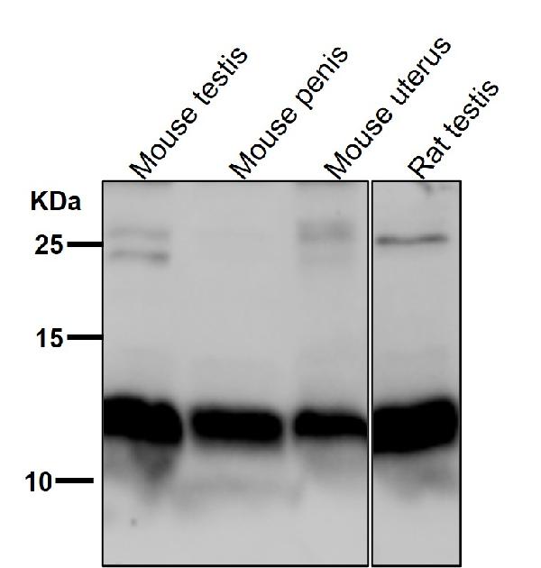 1 - Anti-PEN2 Rabbit Monoclonal Antibody ABO15489