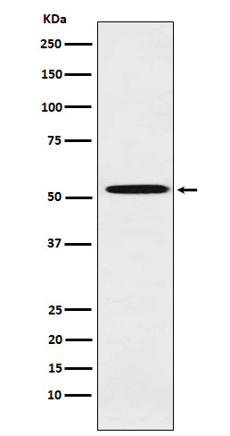 1 - Anti-ALDH1A2 Rabbit Monoclonal Antibody ABO15490