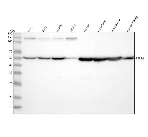 1 - Anti-SFRP4 Rabbit Monoclonal Antibody ABO15491