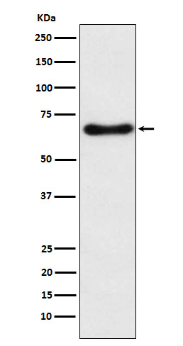 1 - Anti-CYP24A1 Rabbit Monoclonal Antibody ABO15492