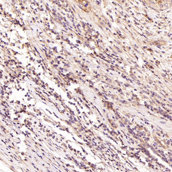 2 - Anti-H Cadherin Rabbit Monoclonal Antibody ABO15494