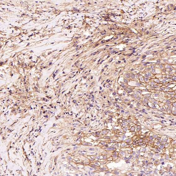 2 - Anti-H Cadherin Rabbit Monoclonal Antibody ABO15494