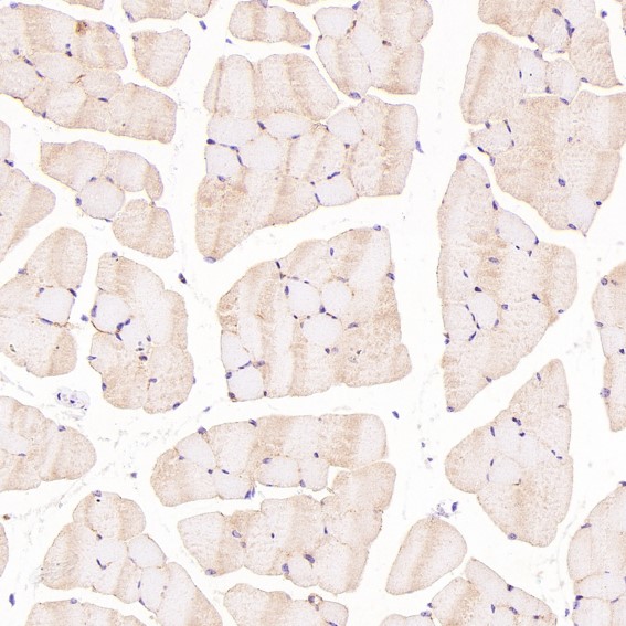 2 - Anti-H Cadherin Rabbit Monoclonal Antibody ABO15494