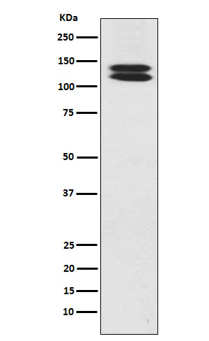 1 - Anti-H Cadherin Rabbit Monoclonal Antibody ABO15494