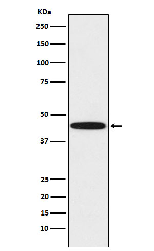 1 - Anti-DDB2 Rabbit Monoclonal Antibody ABO15497