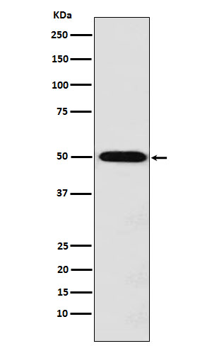 1 - Anti-MCT1 Rabbit Monoclonal Antibody ABO15500