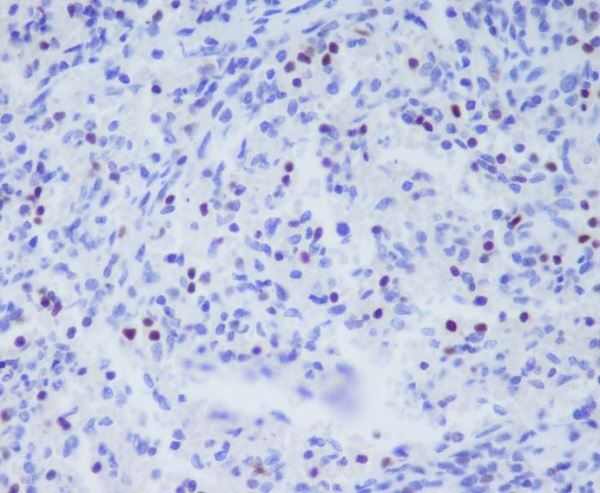 2 - Anti-TBX21 Rabbit Monoclonal Antibody ABO15501