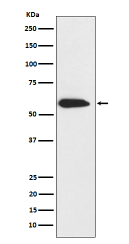 1 - Anti-Cytokeratin 6 Rabbit Monoclonal Antibody ABO15502