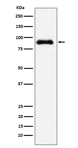 1 - Anti-SATB2 Rabbit Monoclonal Antibody ABO15503