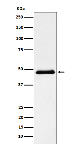 1 - Anti-Pancreatic Lipase （PNLIP） Rabbit Monoclonal Antibody ABO15504