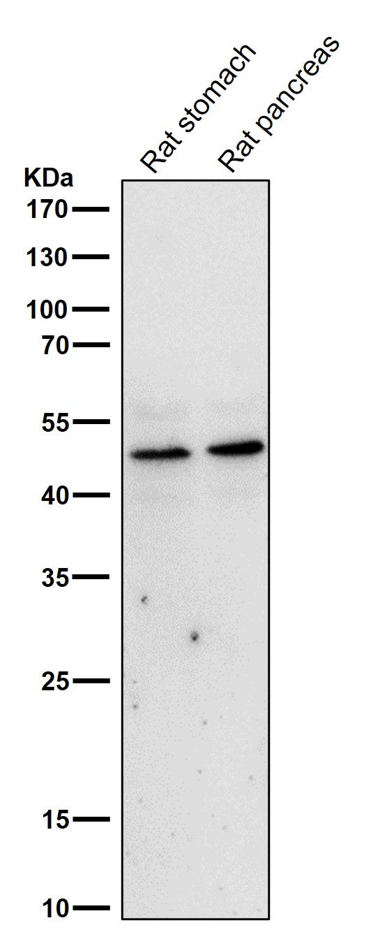 1 - Anti-MyoD Rabbit Monoclonal Antibody ABO15505