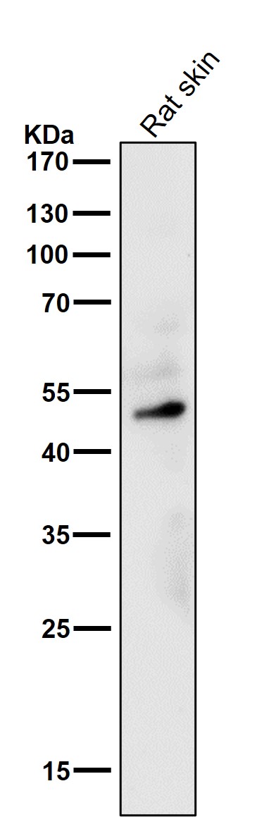 1 - Anti-MyoD Rabbit Monoclonal Antibody ABO15505