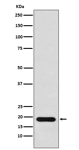1 - Anti-NM23 Rabbit Monoclonal Antibody ABO15507