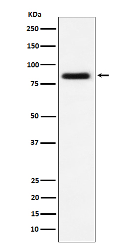 1 - Anti-CD105 Rabbit Monoclonal Antibody ABO15508