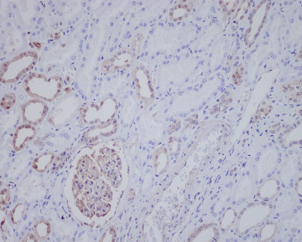 2 - Anti-ALK Rabbit Monoclonal Antibody ABO15509