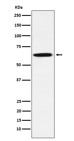 1 - Anti-GRB7 Rabbit Monoclonal Antibody ABO15510