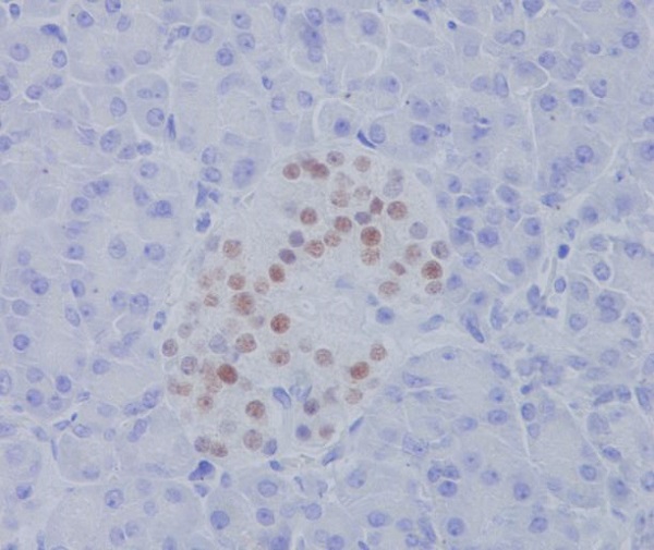2 - Anti-NKX2.2 Rabbit Monoclonal Antibody ABO15511