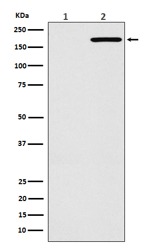 1 - Anti-EGFR(L858R mutation) Rabbit Monoclonal Antibody ABO15512