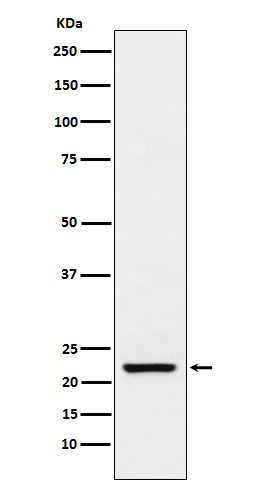 1 - Anti-TAGLN Rabbit Monoclonal Antibody ABO15513