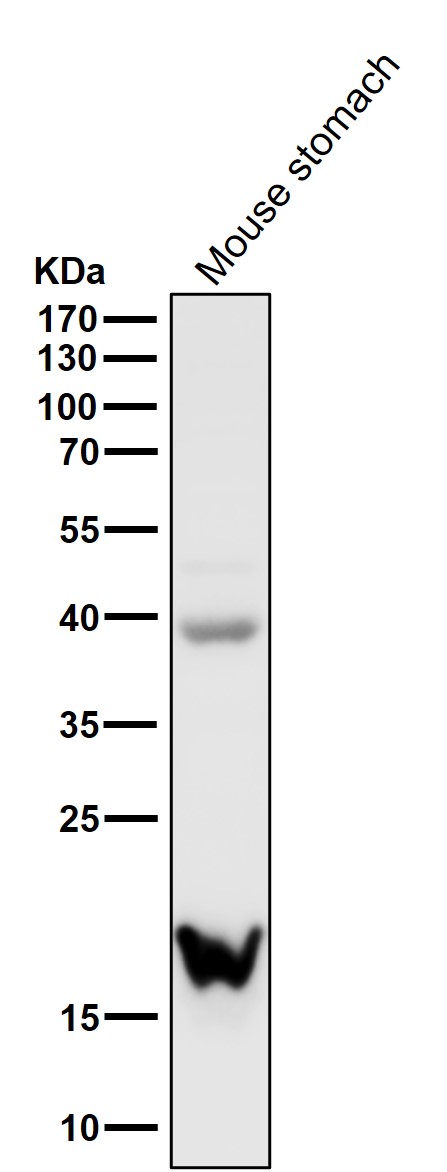 1 - Anti-TAGLN Rabbit Monoclonal Antibody ABO15513