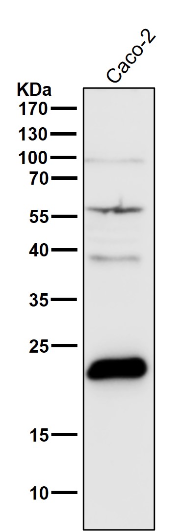 1 - Anti-TAGLN Rabbit Monoclonal Antibody ABO15513