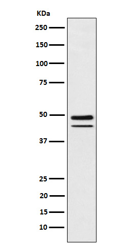 1 - Anti-Brachyury Rabbit Monoclonal Antibody ABO15517