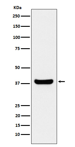 1 - Anti-Protein Phosphatase 1 beta Rabbit Monoclonal Antibody ABO15522