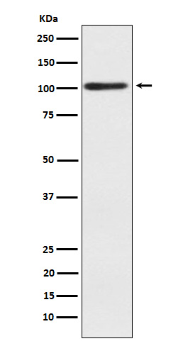 1 - Anti-Alpha actinin 2 Rabbit Monoclonal Antibody ABO15524