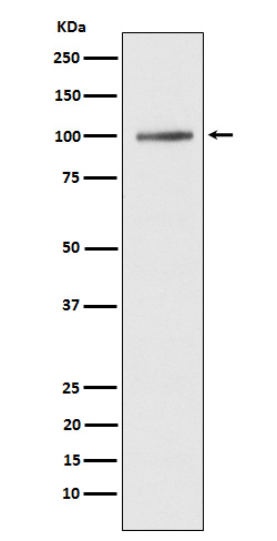 1 - Anti-ATP2A1/SERCA1 Rabbit Monoclonal Antibody ABO15525