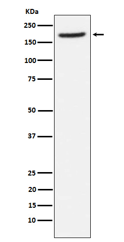 1 - Anti-Aminopeptidase A / CD249 Rabbit Monoclonal Antibody ABO15527