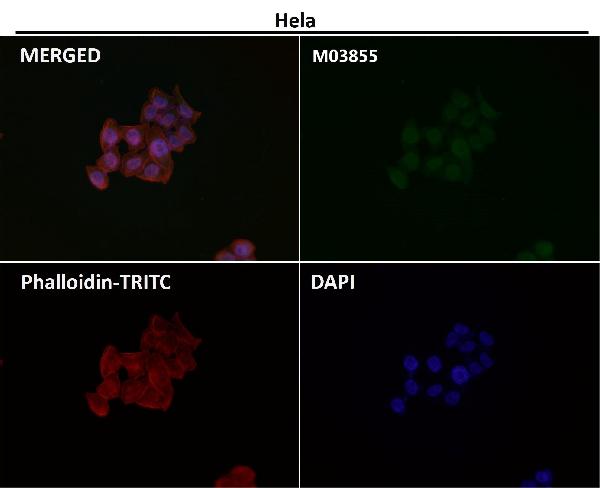 1 - Anti-ATAD2 Rabbit Monoclonal Antibody ABO15531