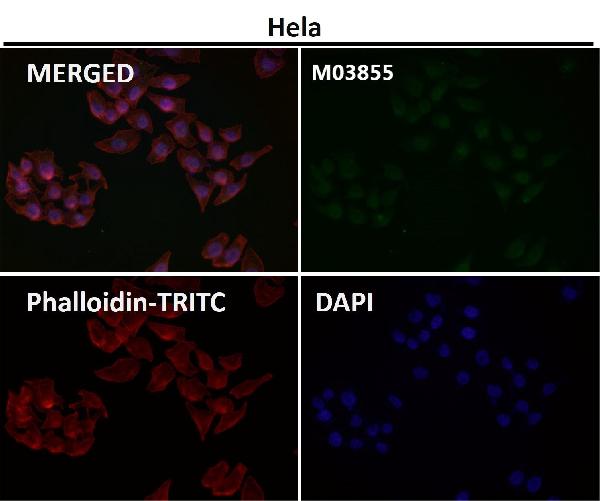 1 - Anti-ATAD2 Rabbit Monoclonal Antibody ABO15531