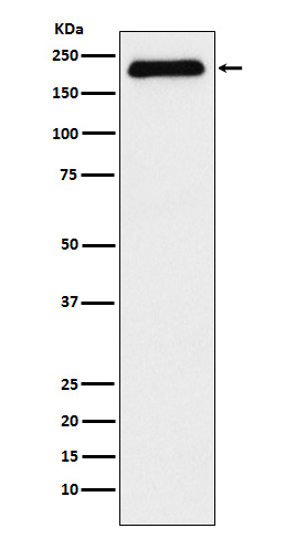 1 - Anti-ATAD2 Rabbit Monoclonal Antibody ABO15531