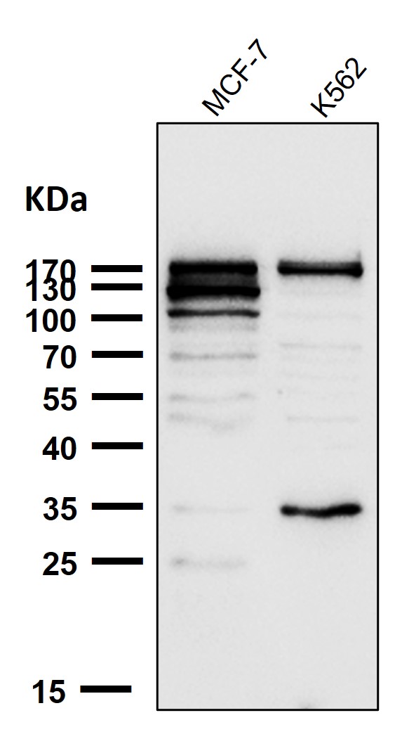 1 - Anti-ATAD2 Rabbit Monoclonal Antibody ABO15531