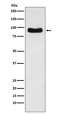 1 - Anti-Cenexin1 / ODF2 Rabbit Monoclonal Antibody ABO15534