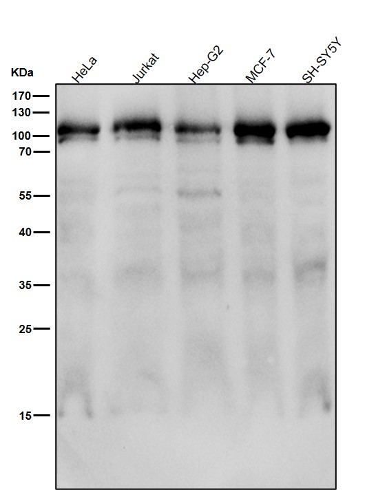 1 - Anti-Cenexin1 / ODF2 Rabbit Monoclonal Antibody ABO15534