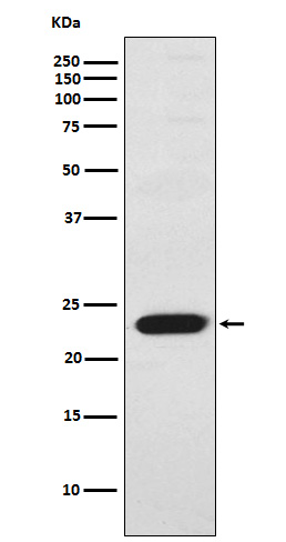 1 - Anti-TNNI2 Rabbit Monoclonal Antibody ABO15537
