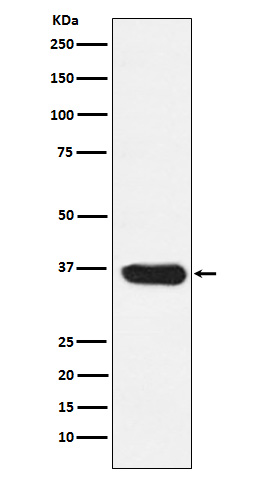 1 - Anti-LDHA Rabbit Monoclonal Antibody ABO15542