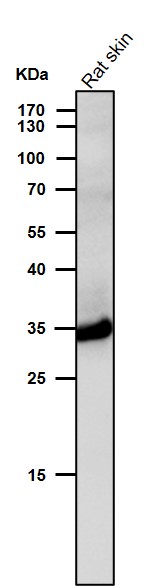 1 - Anti-LDHA Rabbit Monoclonal Antibody ABO15542