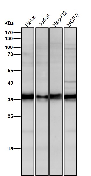 1 - Anti-LDHA Rabbit Monoclonal Antibody ABO15542