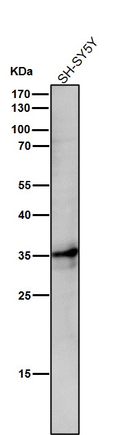 1 - Anti-LDHA Rabbit Monoclonal Antibody ABO15542