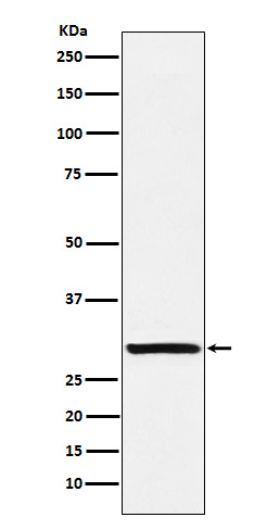1 - Anti-Intra Acrosomal Protein Rabbit Monoclonal Antibody ABO15543