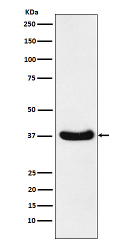 1 - Anti-AKR1C3 Rabbit Monoclonal Antibody ABO15544