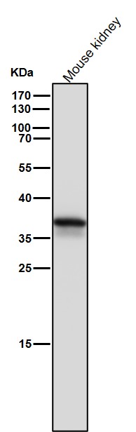 1 - Anti-AKR1C3 Rabbit Monoclonal Antibody ABO15544