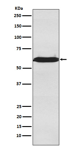 1 - Anti-U2AF65 Rabbit Monoclonal Antibody ABO15545