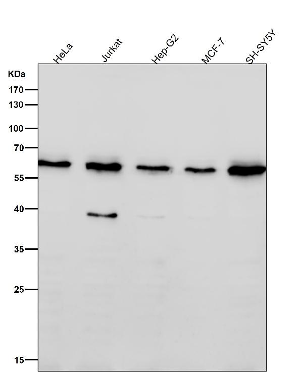 1 - Anti-U2AF65 Rabbit Monoclonal Antibody ABO15545