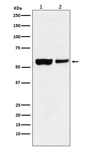 1 - Anti-USP22 Rabbit Monoclonal Antibody ABO15549