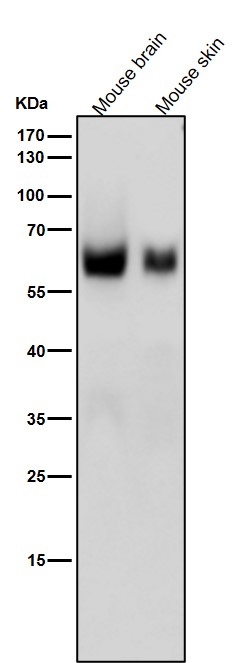1 - Anti-USP22 Rabbit Monoclonal Antibody ABO15549