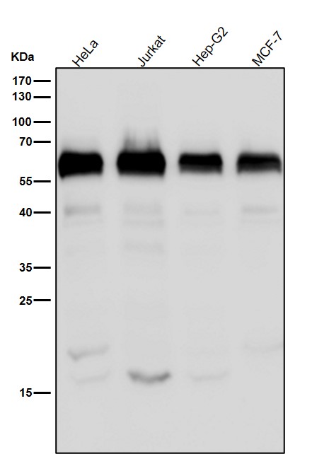 1 - Anti-USP22 Rabbit Monoclonal Antibody ABO15549